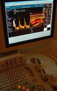 220px-CarotidDoppler1